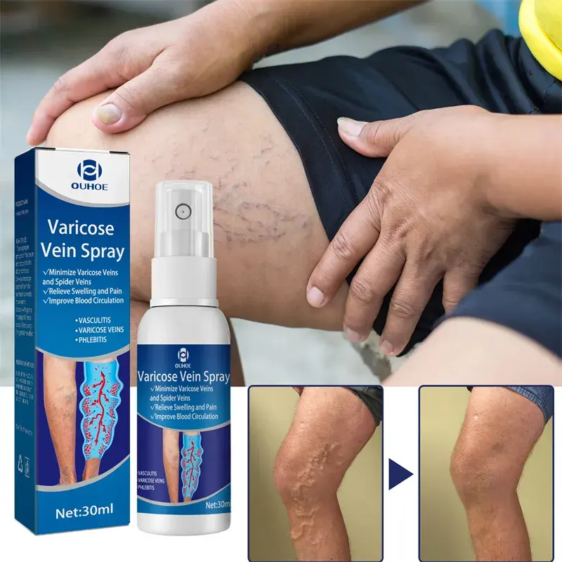 Varicose Vein Spray Original